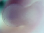 EMAGE:28149