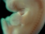 EMAGE:28162