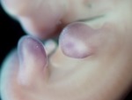 EMAGE:28205