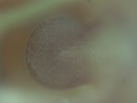 EMAGE:28247
