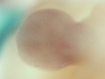 EMAGE:28260