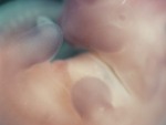 EMAGE:28268