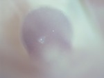 EMAGE:28268