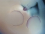 EMAGE:28273