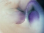 EMAGE:28276