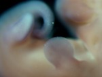 EMAGE:28284