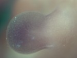 EMAGE:28305