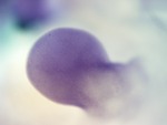 EMAGE:28324