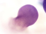 EMAGE:28324
