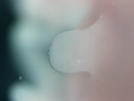 EMAGE:28336