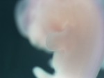 EMAGE:28337