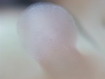 EMAGE:28375