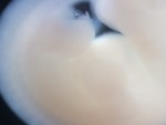 EMAGE:28378