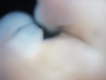 EMAGE:28387