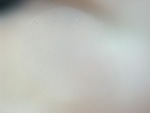 EMAGE:28387
