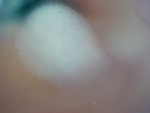 EMAGE:28397