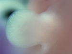 EMAGE:28410