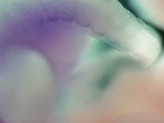 EMAGE:28410