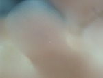 EMAGE:28410