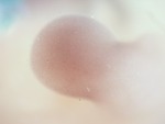 EMAGE:28413