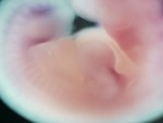 EMAGE:28456