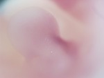 EMAGE:28456