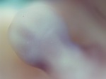 EMAGE:28457