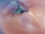 EMAGE:28473