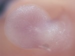 EMAGE:28473