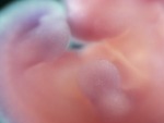 EMAGE:28481