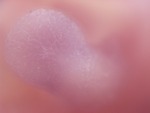 EMAGE:28481