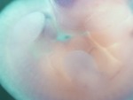 EMAGE:28484