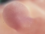 EMAGE:28503