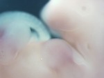 EMAGE:28516