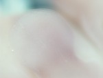 EMAGE:28516