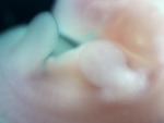 EMAGE:28528