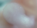 EMAGE:28528
