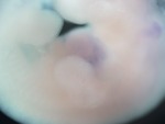 EMAGE:28529