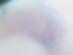 EMAGE:28529