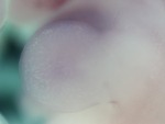 EMAGE:28537