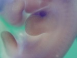 EMAGE:28539
