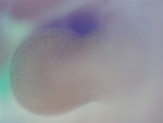 EMAGE:28539