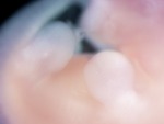 EMAGE:28543