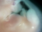 EMAGE:28543