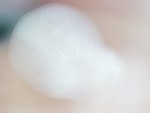 EMAGE:28543