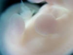 EMAGE:28545