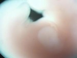 EMAGE:28556