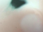 EMAGE:28556