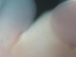 EMAGE:28559