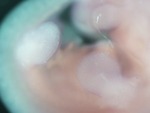 EMAGE:28572